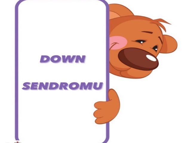 Down sendromu - 27 Ocak 2021